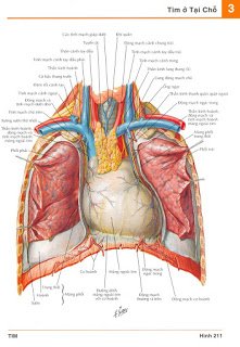 GÂY MÊ HỒI SỨC TRONG PHẪU THUẬT LỒNG NGỰC