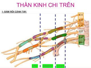 PHONG BẾ THẦN KINH NGOẠI VI CHI TRÊN