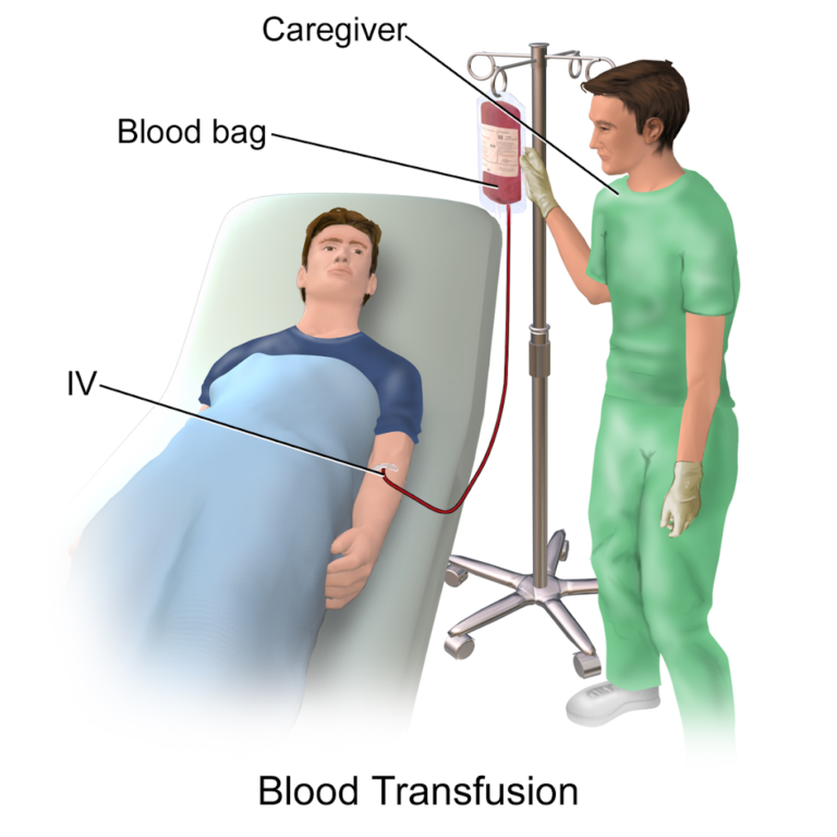 TRUYỀN MÁU HOÀN HỒI BẰNG MÁY CELLSAVER