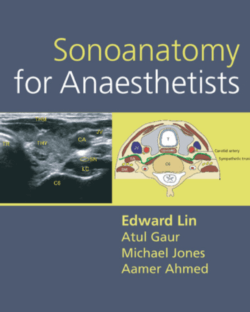 SONOANATOMY FOR ANAESTHETISTS