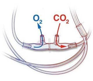 OXYGEN LIỆU PHÁP