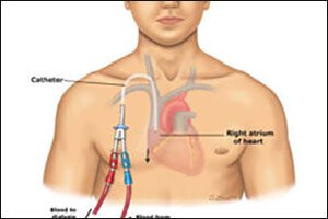 Sốc mất máu: Từ sinh lý bệnh đến điều trị