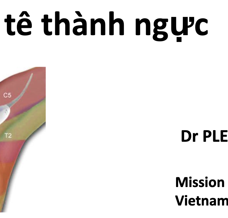 GÂY TÊ THÀNH NGỰC