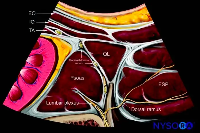 Quadratus Lumborum Blocks