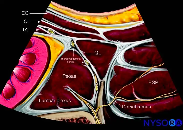 Quadratus Lumborum Blocks